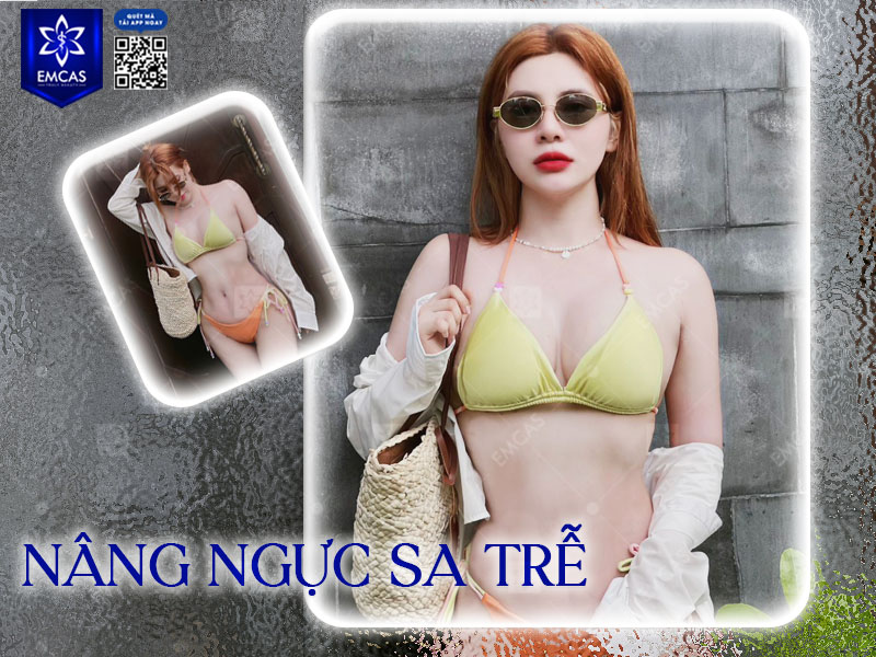 Bệnh Viện Thẩm Mỹ EMCAS là một trong những địa chỉ được nhiều khách hàng tin tưởng khi có nhu cầu cải thiện vòng 1 chảy xệ của mình.