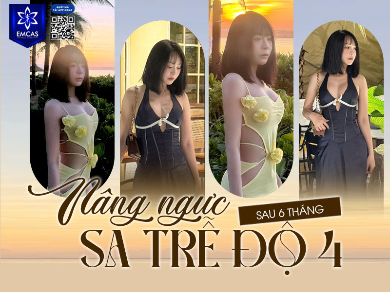 Không có một mức cố định áp dụng cho tất cả các trường hợp treo sa trễ, bởi chi phí còn phụ thuộc vào nhiều yếu tố chuyên môn khác nhau.