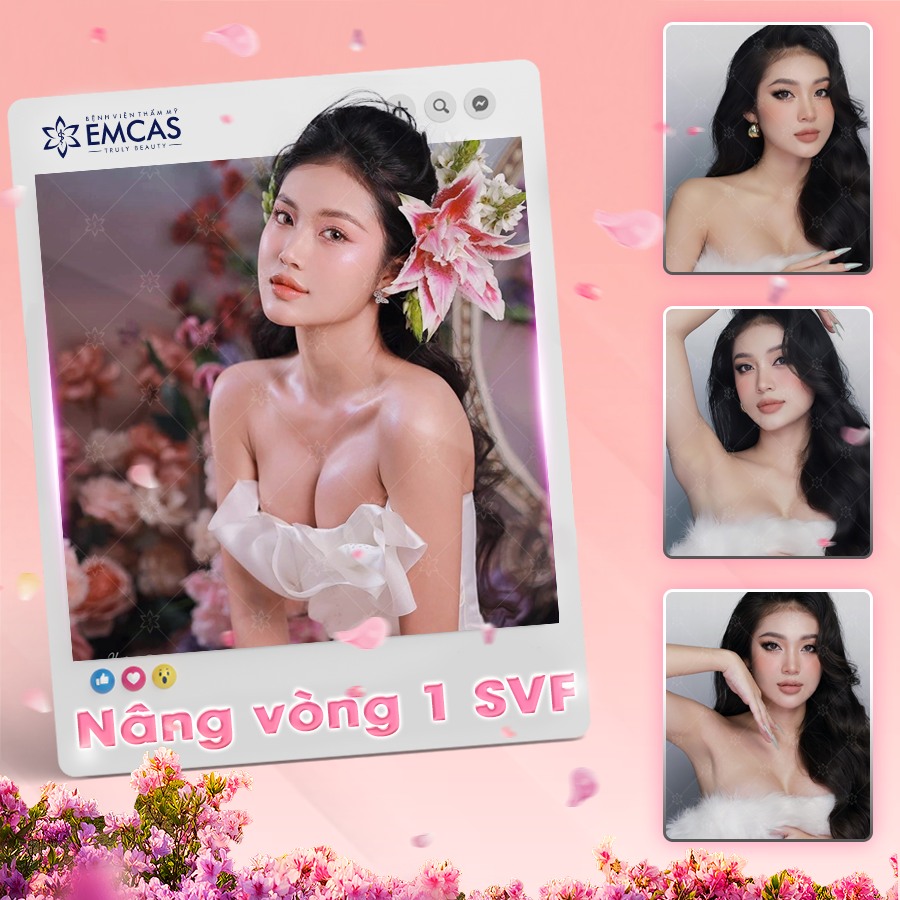 Nâng ngực bằng SVF có một số ưu điểm so với các phương pháp nâng ngực truyền thống