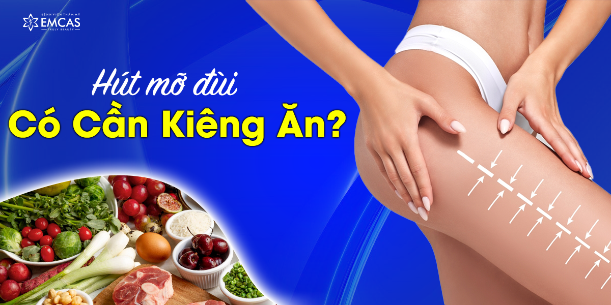 Hút Mỡ Đùi Có Cần Kiêng Ăn?
