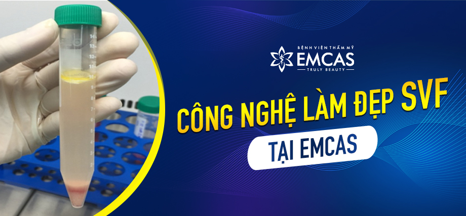 Công Nghệ Làm Đẹp SVF Tại EMCAS