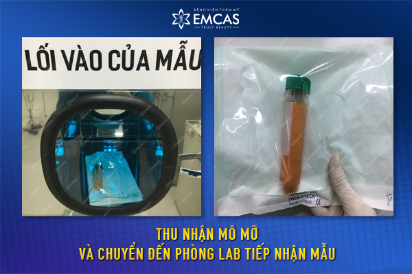 Công Nghệ Làm Đẹp SVF Tại EMCAS