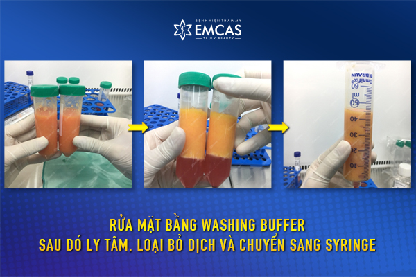 Công Nghệ Làm Đẹp SVF Tại EMCAS