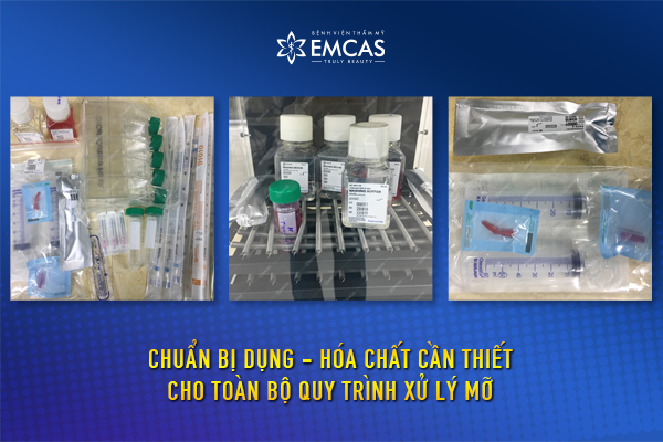 Công Nghệ Làm Đẹp SVF Tại EMCAS