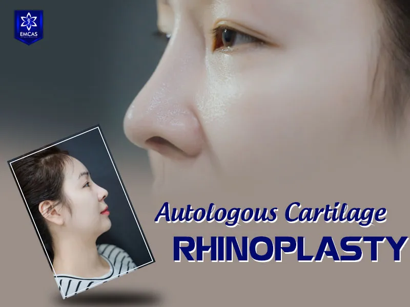 EMCAS Aesthetic Hospital for ear cartilage rhinoplasty in Ho Chi Minh City