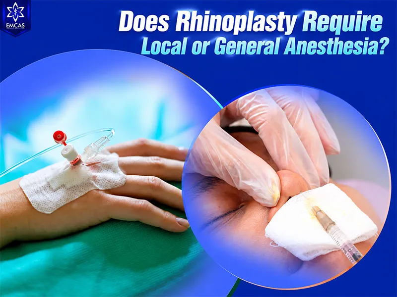 The anesthesia plan for rhinoplasty depends on the procedure and individual medical assessment