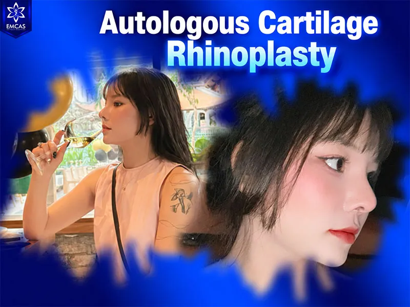 The rhinoplasty process at EMCAS includes consultation, preoperative assessment, the procedure and postoperative monitoring
