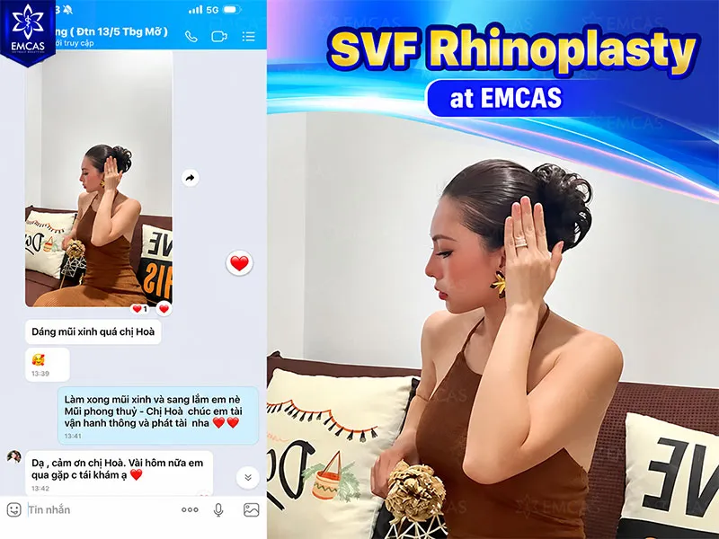 Patient feedback and rhinoplasty care at EMCAS Aesthetic Hospital