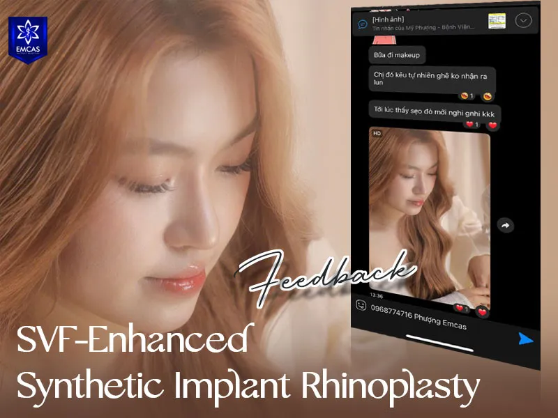 Potential benefits of synthetic nasal implants include material availability, custom shaping, and long-term bridge support