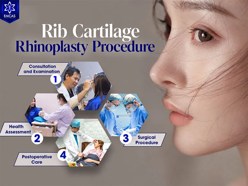 Rib cartilage rhinoplasty at EMCAS includes consultation, preoperative assessment, surgery, and postoperative monitoring
