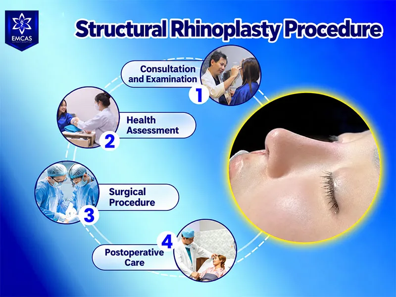 Four-step structural rhinoplasty procedure at EMCAS Aesthetic Hospital
