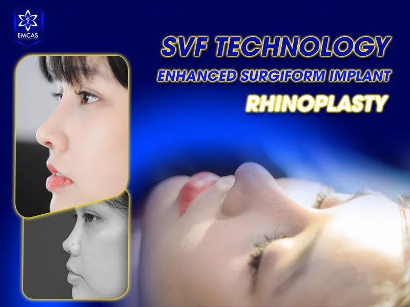 Surgiform ePTFE nasal implant designed for long-term rhinoplasty support