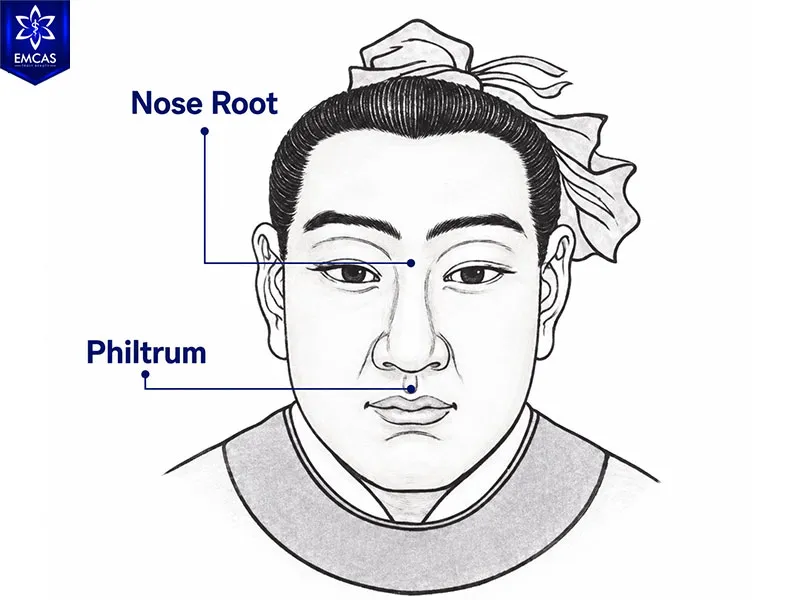 Dragon nose with a high straight bridge, rounded tip and full nasal alae