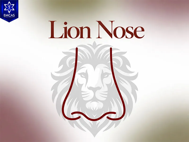 Lion nose with a broad rounded tip and full nasal alae
