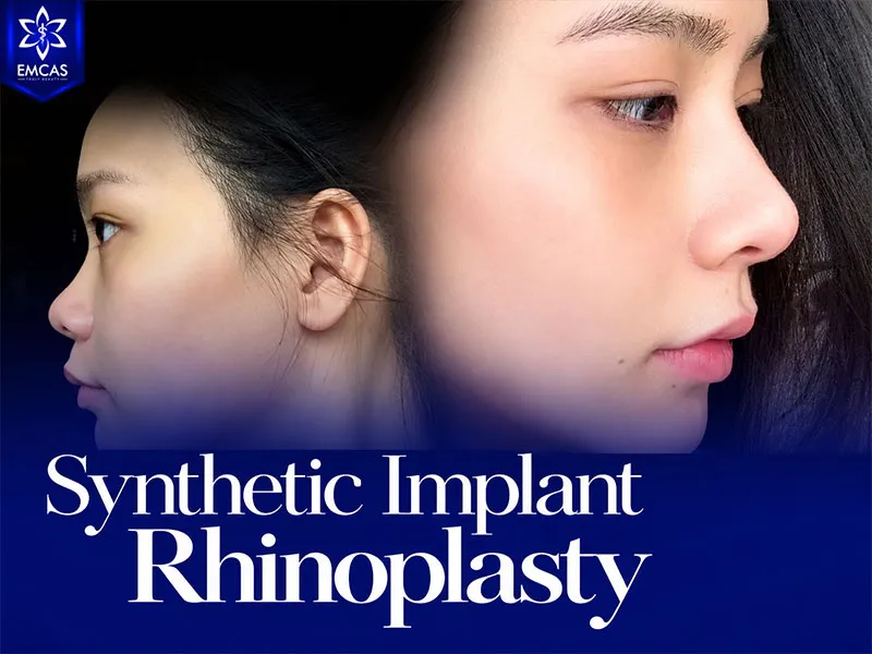 Rhinoplasty can reshape the nasal bridge, tip and overall proportions