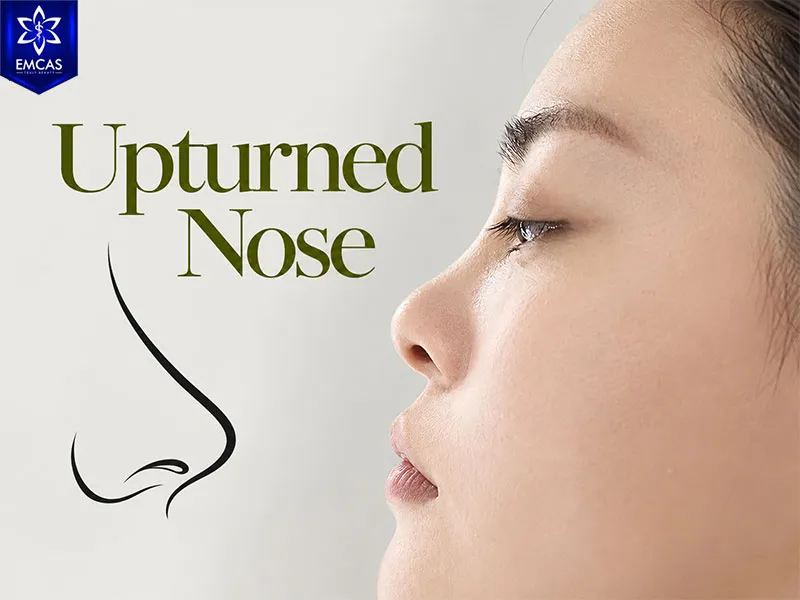 Upturned nose with a short elevated nasal tip and more visible nostrils