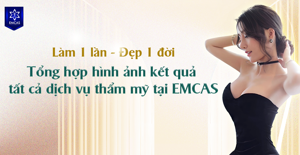 TỔNG HỢP HÌNH ẢNH KẾT QUẢ TẤT CẢ DỊCH VỤ THẨM MỸ TẠI EMCAS