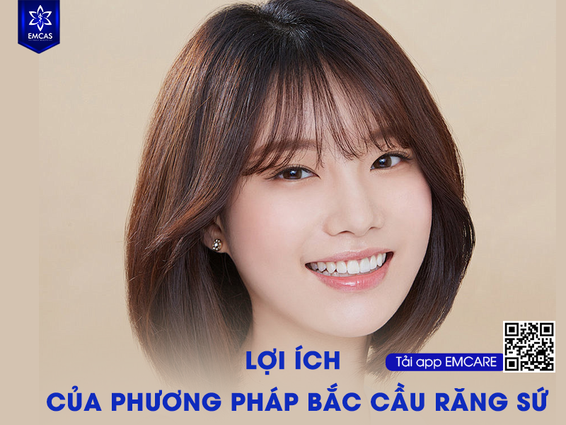 BẮC CẦU RĂNG SỨ
