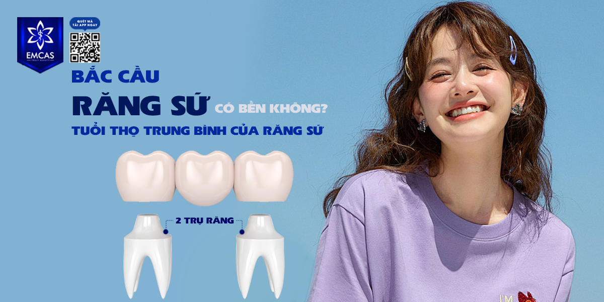 Bắc Cầu Răng Sứ Có Bền Không? Tuổi Thọ Trung Bình Của Răng Sứ