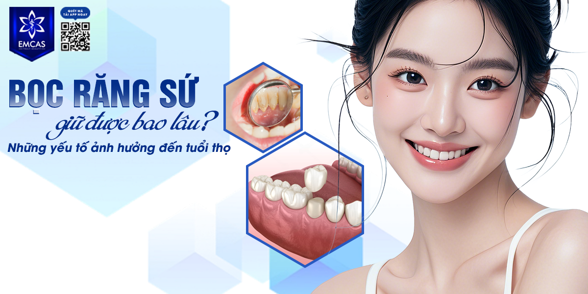 Bọc Răng Sứ Giữ Được Bao Lâu? Những Yếu Tố Ảnh Hưởng Đến Tuổi Thọ