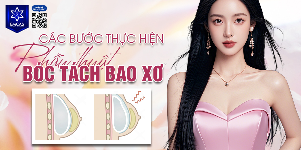 Các Bước Thực Hiện Phẫu Thuật Bóc Tách Bao Xơ