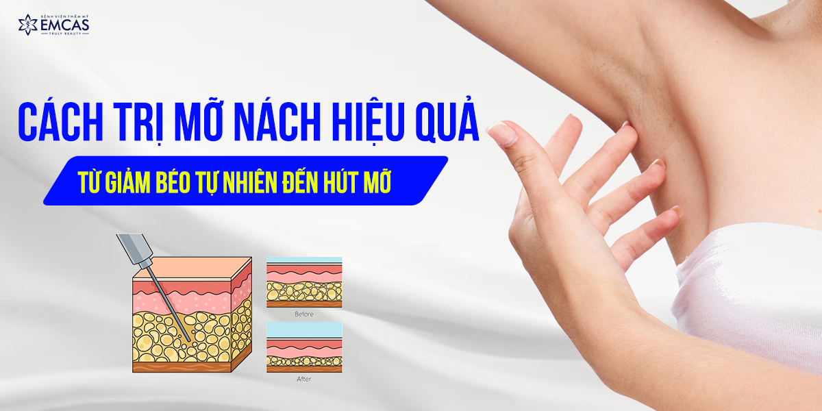 Cách Trị Mỡ Nách Hiệu Quả - Từ Giảm Béo Tự Nhiên Đến Hút Mỡ