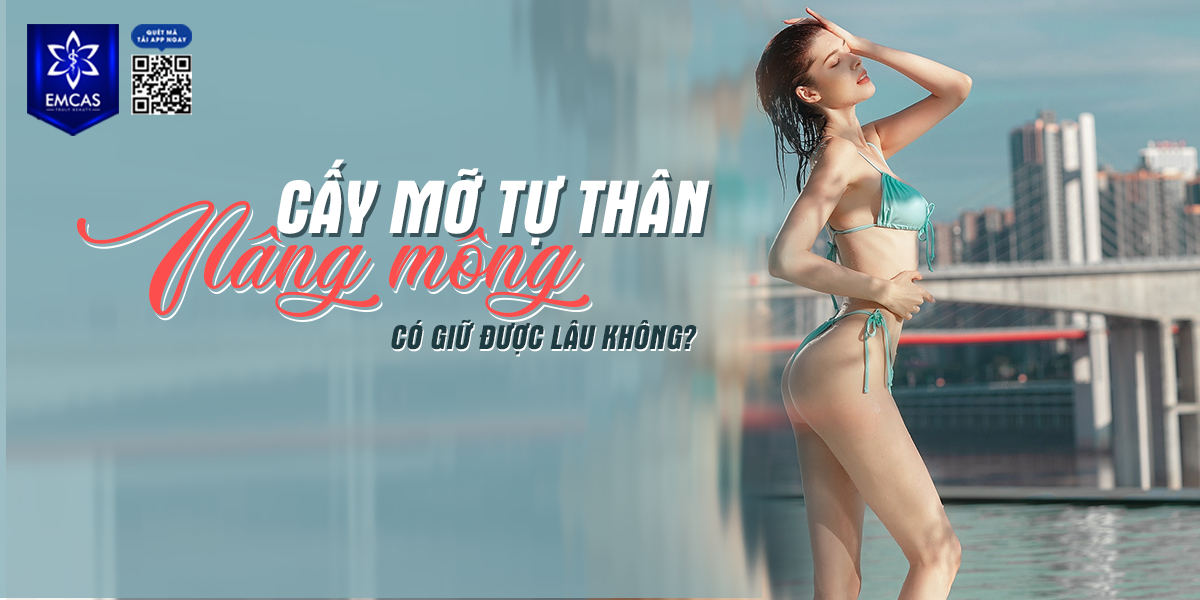 Cấy Mỡ Tự Thân Nâng Mông Có Giữ Được Lâu Không?