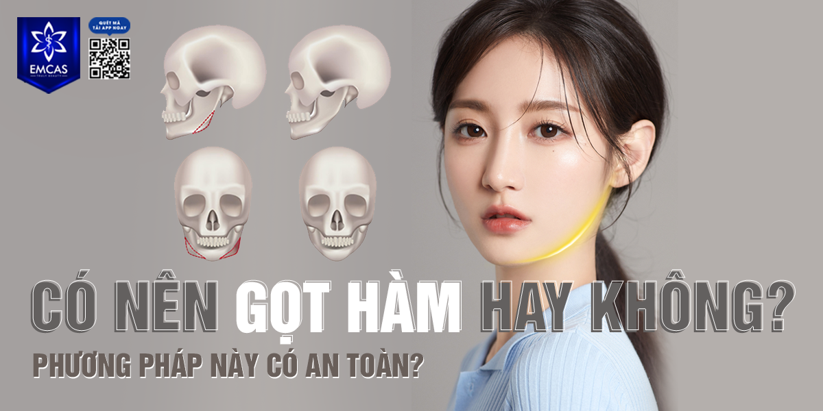 Có Nên Gọt Hàm Hay Không? Phương Pháp Này Có An Toàn?