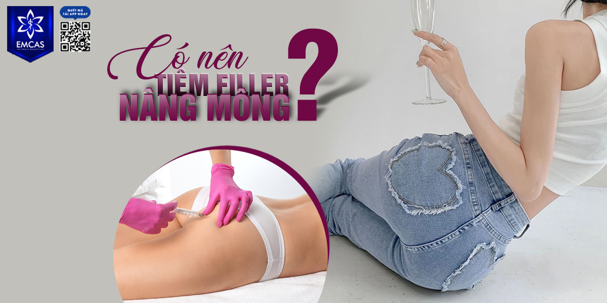 Có Nên Tiêm Filler Nâng Mông Không?