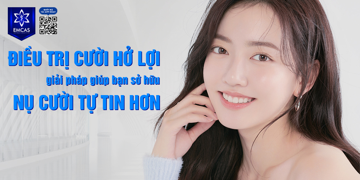 Điều Trị Cười Hở Lợi - Giải Pháp Giúp Bạn Sở Hữu Nụ Cười Tự Tin Hơn
