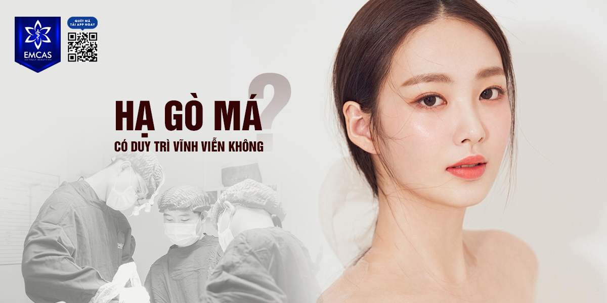 Hạ Gò Má Có Duy Trì Vĩnh Viễn Không?