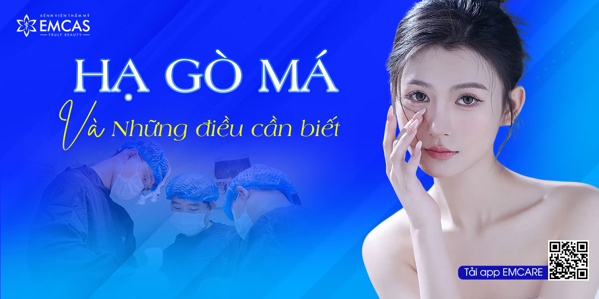 Hạ Gò Má Và Những Điều Cần Biết