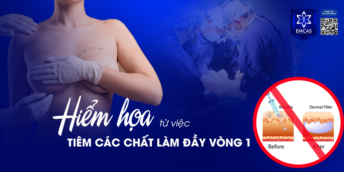 Hiểm Họa Từ Việc Tiêm Chất Làm Đầy Vòng 1