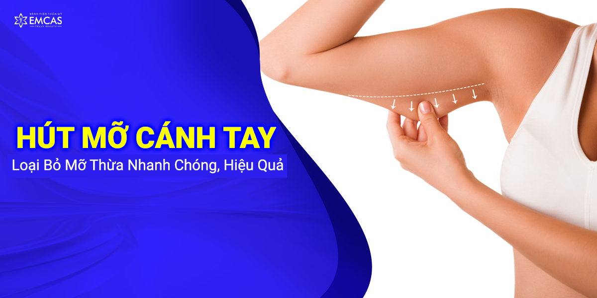 Hút Mỡ Cánh Tay – Loại Bỏ Mỡ Thừa Nhanh Chóng, Hiệu Quả
