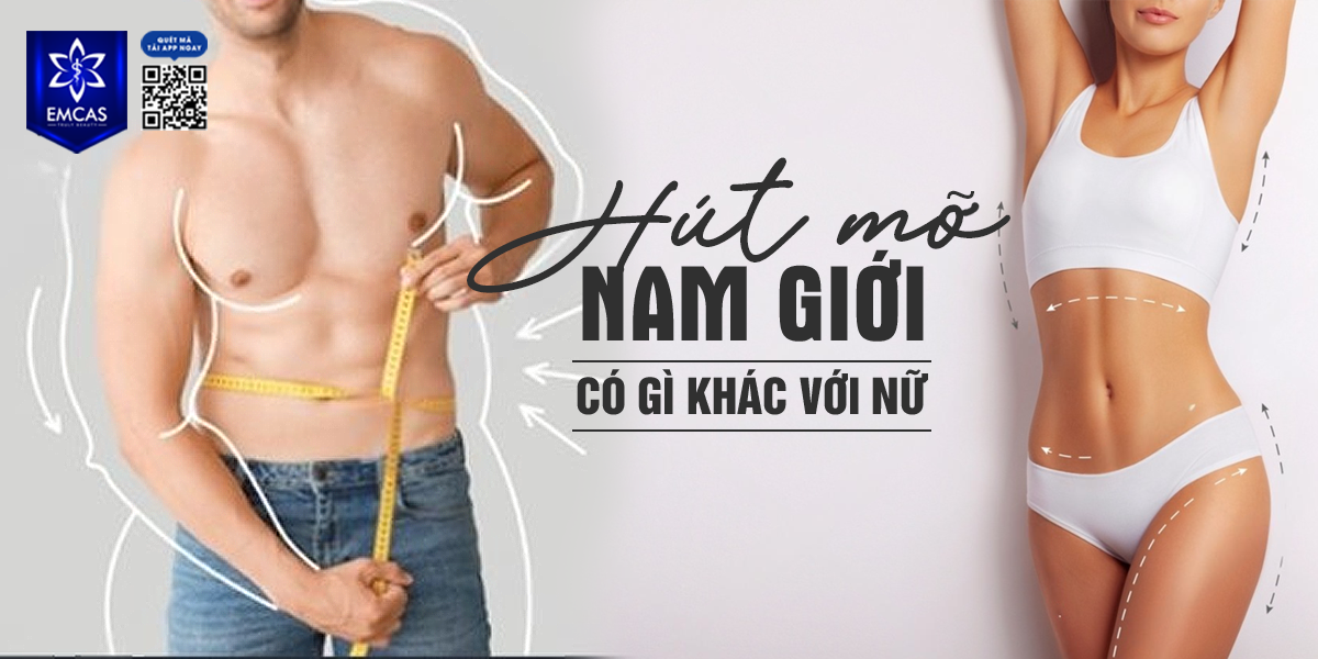Hút Mỡ Nam Giới Có Gì Khác Với Nữ