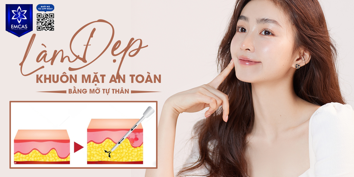 Làm Đẹp Khuôn Mặt An Toàn Bằng Mỡ Tự Thân
