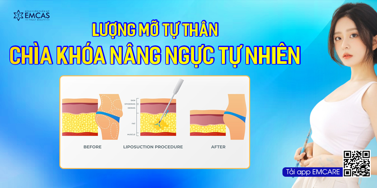 Lượng Mỡ Tự Thân - Chìa Khóa Nâng Ngực Tự Nhiên