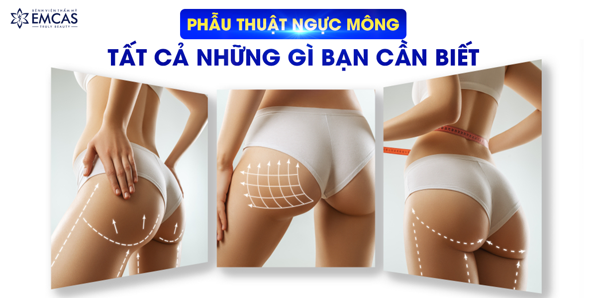 Phẫu Thuật Ngực Mông: Tất Cả Những Gì Bạn Cần Biết