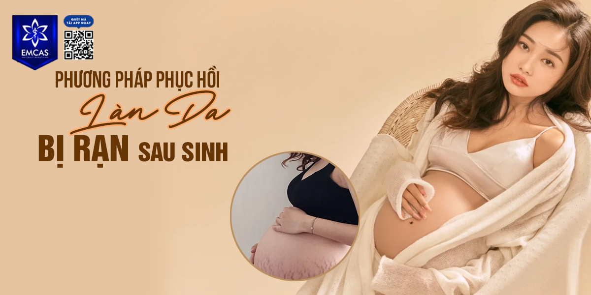 Phương Pháp Phục Hồi Làn Da Bị Rạn Sau Sinh