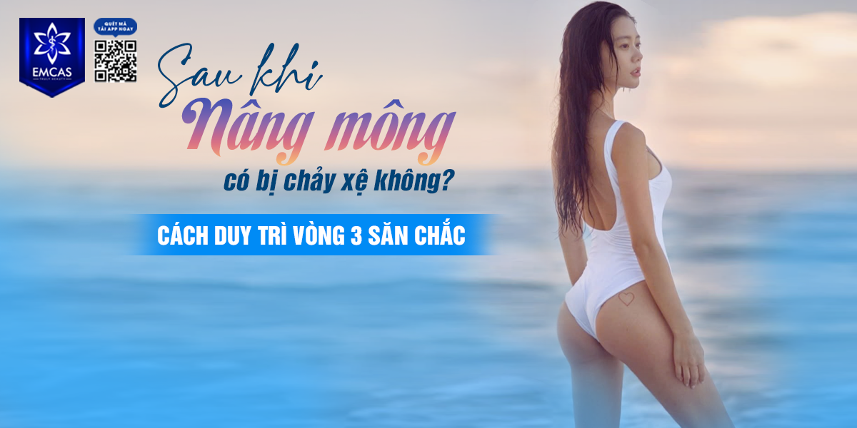Sau Khi Nâng Mông Có Bị Chảy Xệ Không? Cách Duy Trì Vòng 3 Săn Chắc