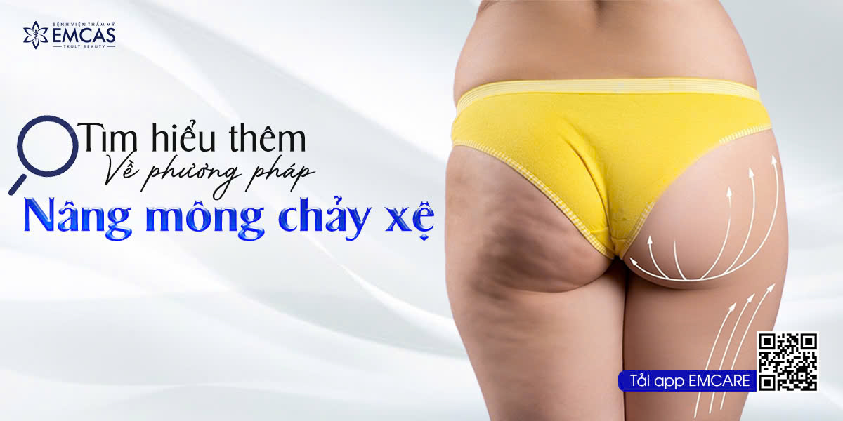 Tìm Hiểu Thêm Về Phương Pháp Nâng Mông Chảy Xệ