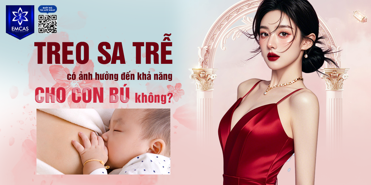 Treo Sa Trễ Có Ảnh Hưởng Đến Khả Năng Cho Con Bú Không?