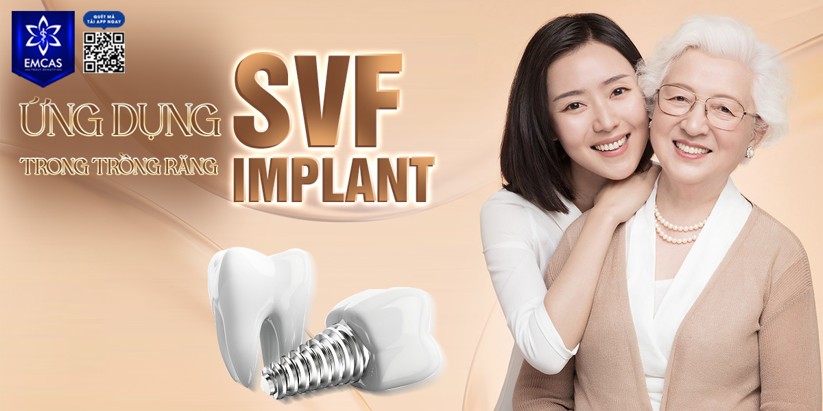 Ứng Dụng SVF Trong Trồng Răng Implant