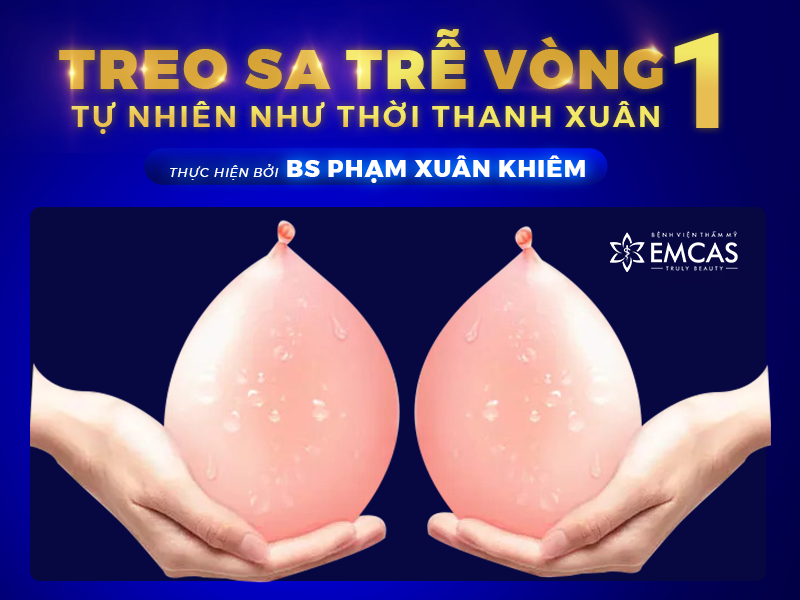 Cấp Độ Sa Trễ Của Ngực Và Kỹ Thuật Khắc Phục