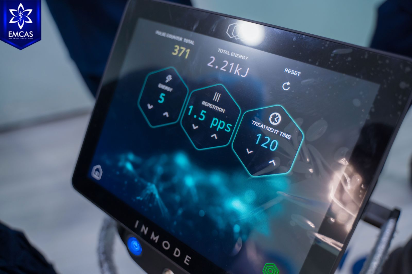 Giao diện màn hình điều khiển của máy Ignite RF được sử dụng tại Bệnh Viện Thẩm Mỹ EMCAS