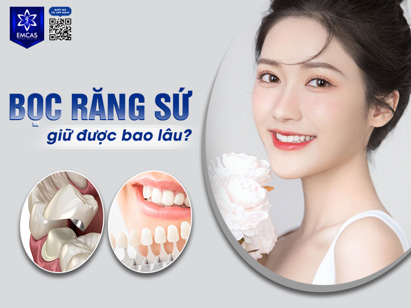 Bọc Răng Sứ Giữ Được Bao Lâu? Những Yếu Tố Ảnh Hưởng Đến Tuổi Thọ