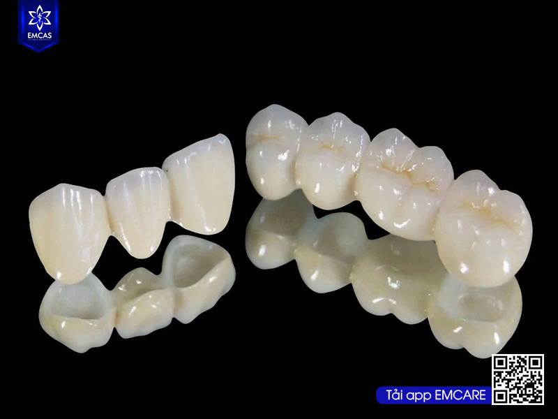 BẮC CẦU RĂNG SỨ