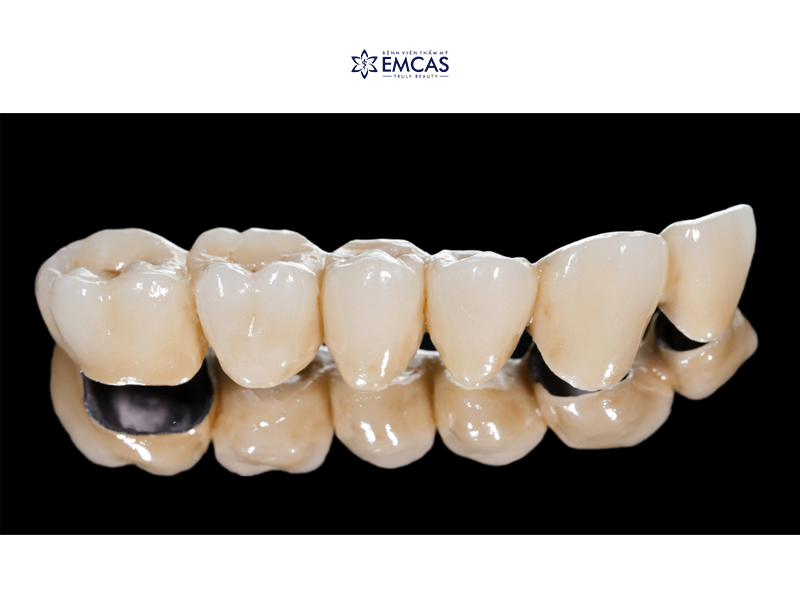 Bắc Cầu Răng Sứ - Giải Pháp Phục Hình Răng Mất Hiệu Quả