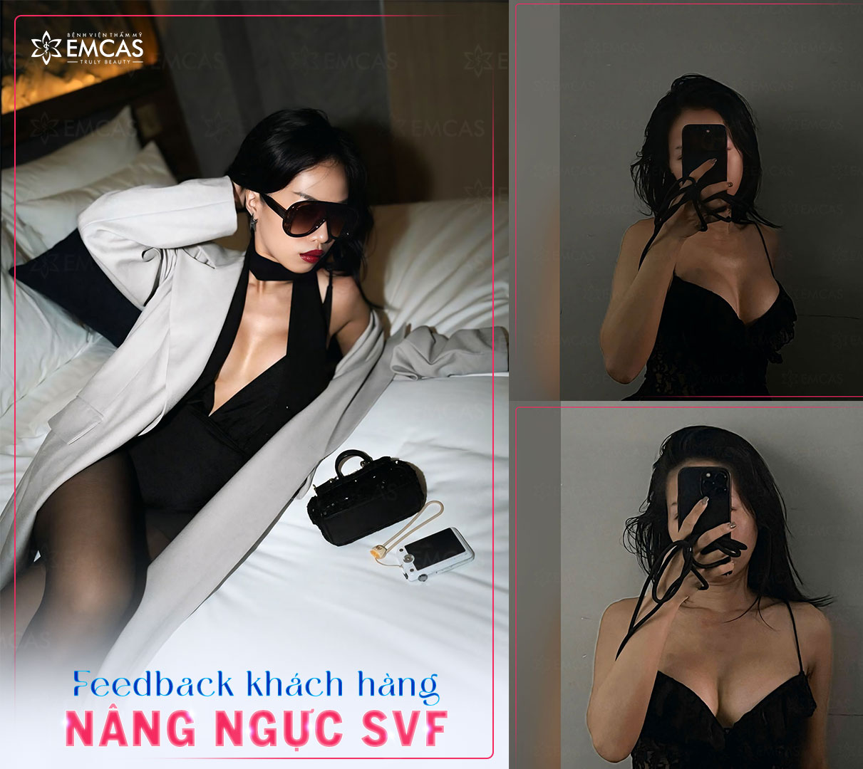 Nâng Ngực Bao Lâu Thì Đẹp? Bí Quyết Để Nhanh Phục Hồi