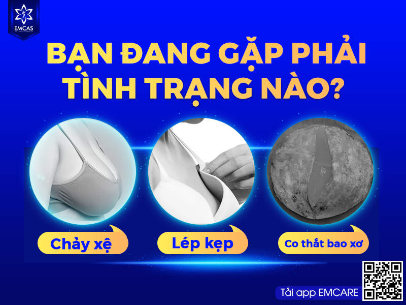 LỢI ÍCH CỦA PHƯƠNG PHÁP NÂNG NGỰC